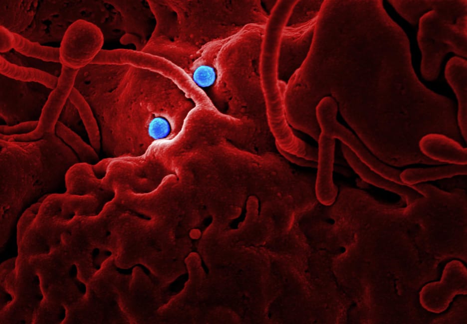 Ebola Cases Double Every 7 Days in New Outbreak