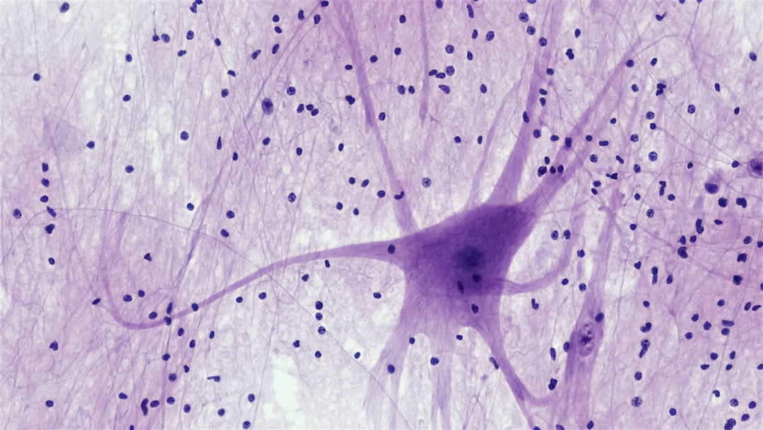 How CBD Fights Alzheimer’s