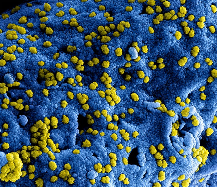 New Protein Pathway Reveals Why Only Some Alpha-1 Patients Develop Liver Disease