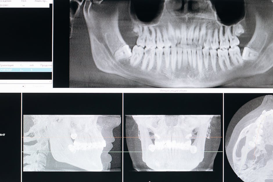 Skull Shape Surges in 100 Years Due to Lifestyle Shifts