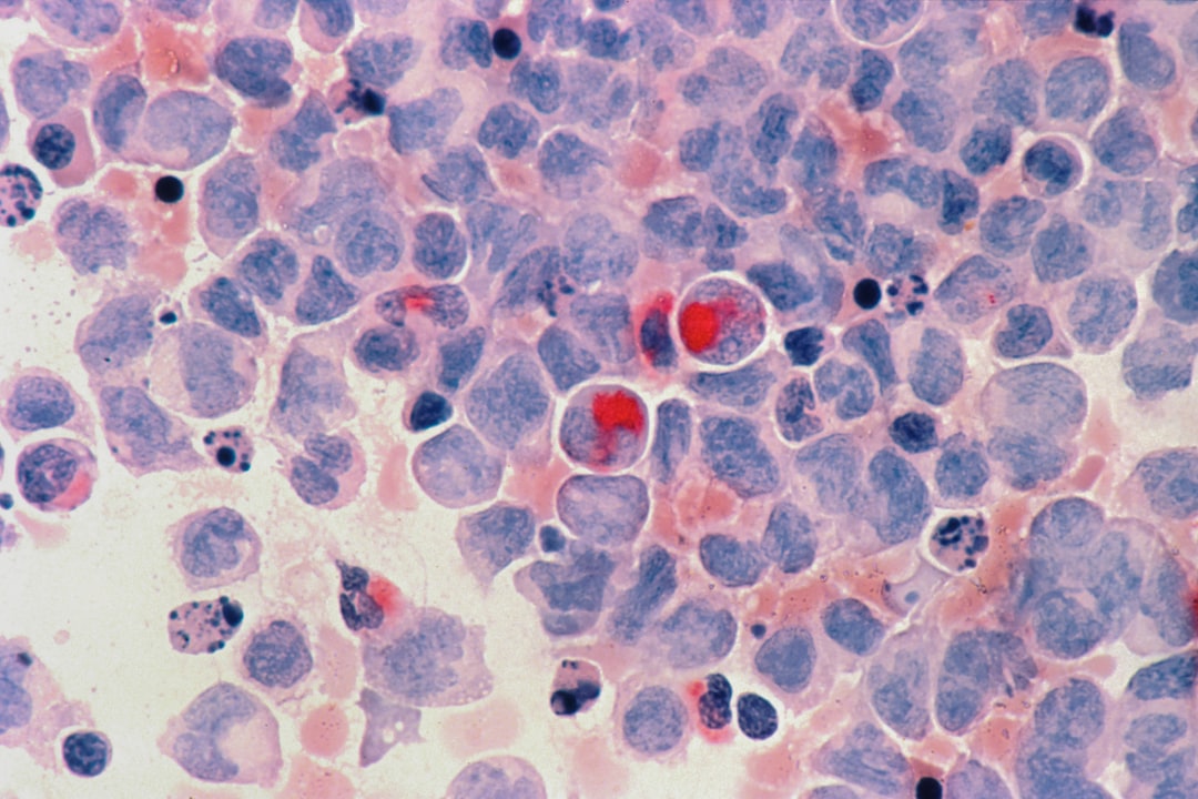 Smaller Cancer Cells Surges Risk in Tumor Aggressiveness, Study Reveals