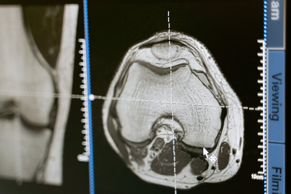 Study Finds 70% Brain Function Improvement in Recovery