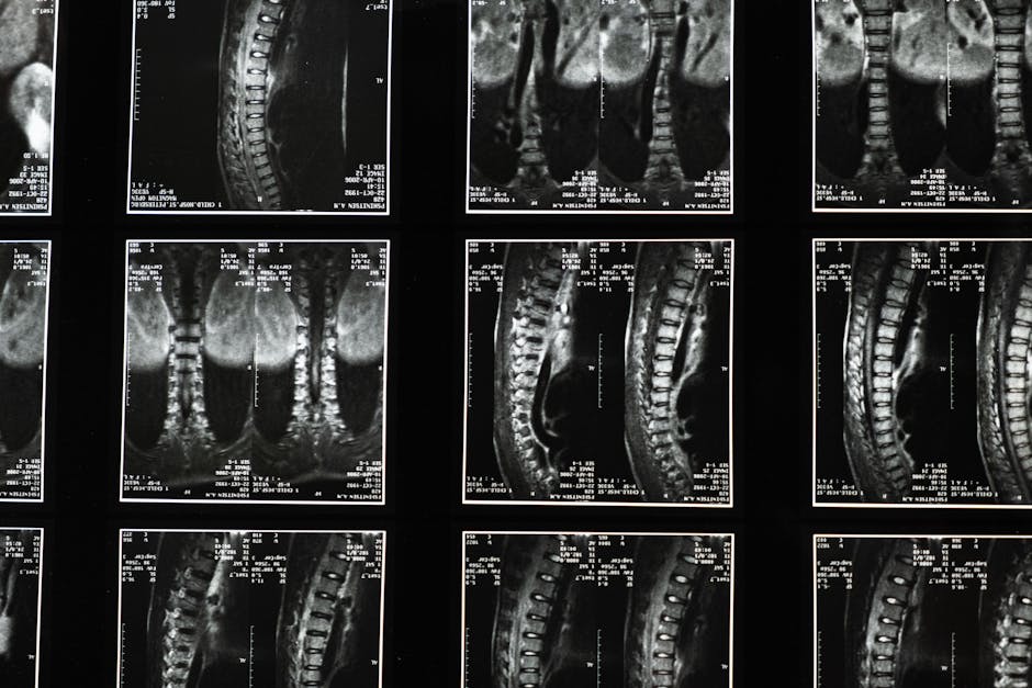 Breakthrough Study Reveals Spinal Cord Stimulation Benefits for Stroke Victims - VirentaNews