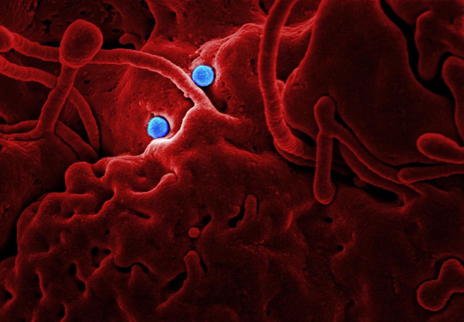 Ebola Outbreak: Border Shutdown Hits Trade