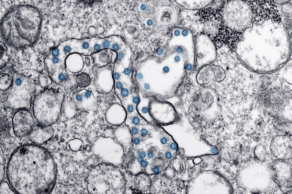 FDA Approves First Treatment for Chronic Hepatitis Delta Virus Infection