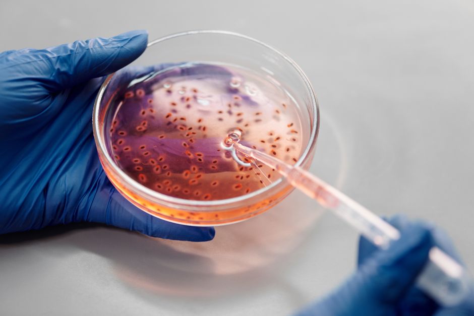 Genetic Variation in Cell Types Reveals New Insights into Inflammatory Bowel Disease Risk - VirentaNews