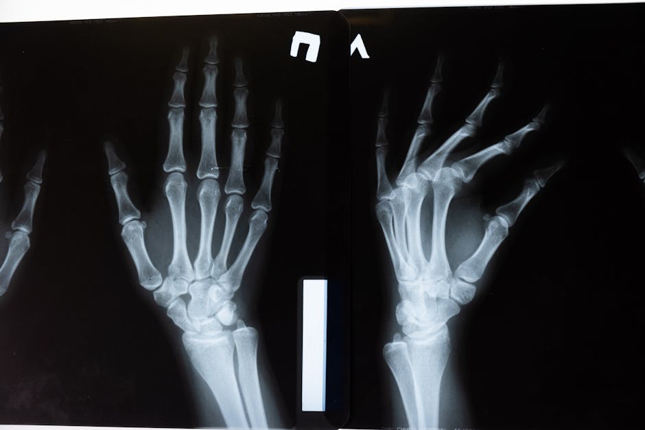 How AI Screens for Osteoporosis - VirentaNews