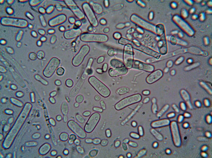 How Faecal Transplant Makes Old Mice Young Again