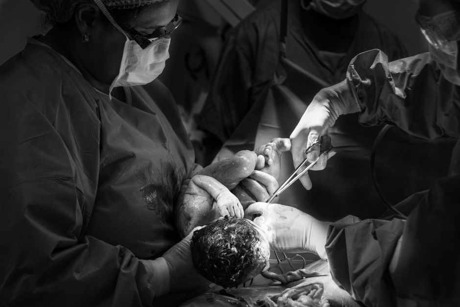 NHS England Sees 1 in 4 Births by Emergency C-section
