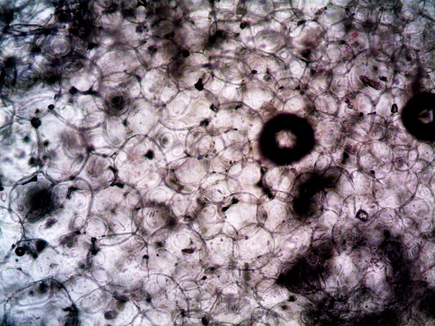 Why Autophagic Cell Death Matters in Replicative Crisis