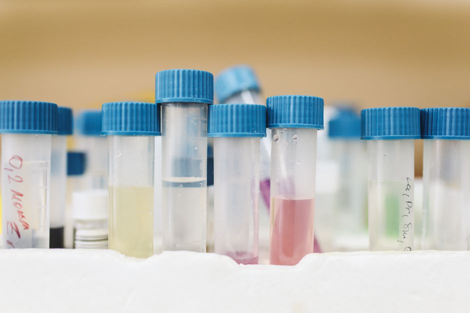 Why Glucosamine May Worsen Cognitive Decline - VirentaNews