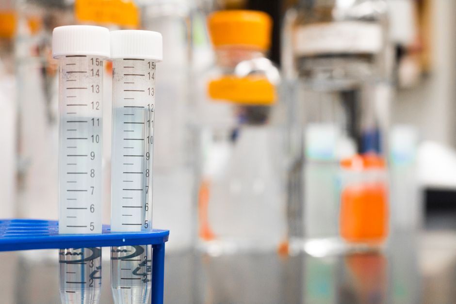 What is Life? Scientists React to Breakthrough SpudCell Discovery - VirentaNews