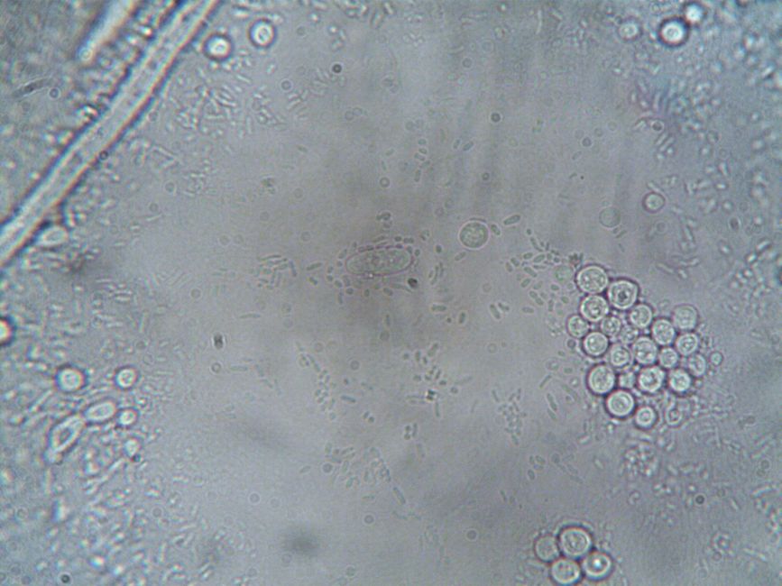 Why Older Muscle Stem Cells Act Young Again