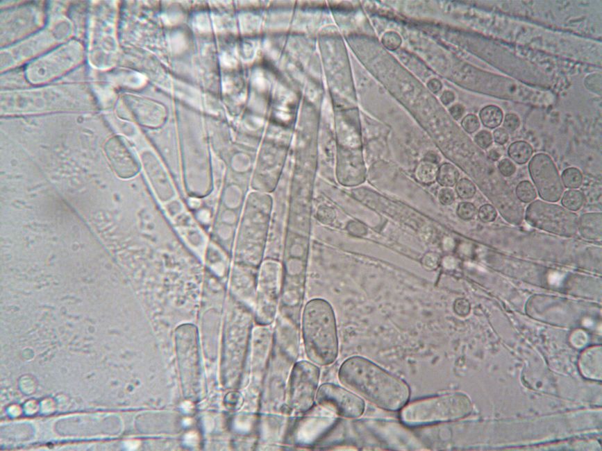 Why Soil Bacteria Matters for Agriculture - VirentaNews